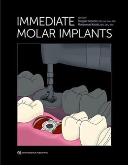 دانلود کتاب Immediate Molar Implants 1st Edition