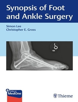 دانلود کتاب Synopsis of Foot and Ankle Surgery 1st Edition