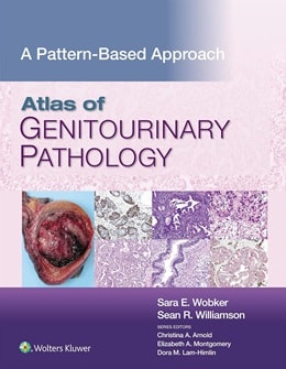 دانلود کتاب Atlas of Genitourinary Pathology: A Pattern Based Approach 1st Edition