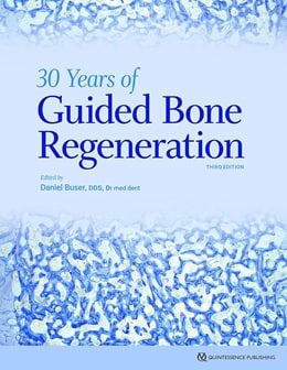 دانلود کتاب 30 Years of Guided Bone Regeneration (GBR) 3rd Edition