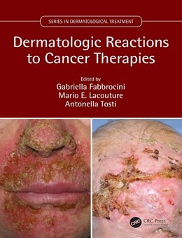 دانلود کتاب Dermatologic Reactions to Cancer Therapies 1st Edition