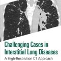 دانلود کتاب موارد چالش‌برانگیز در بیماری‌های بینابینی ریه<br>Challenging Cases in Interstitial Lung Diseases: A High-Resolution CT Approach 1st Edition